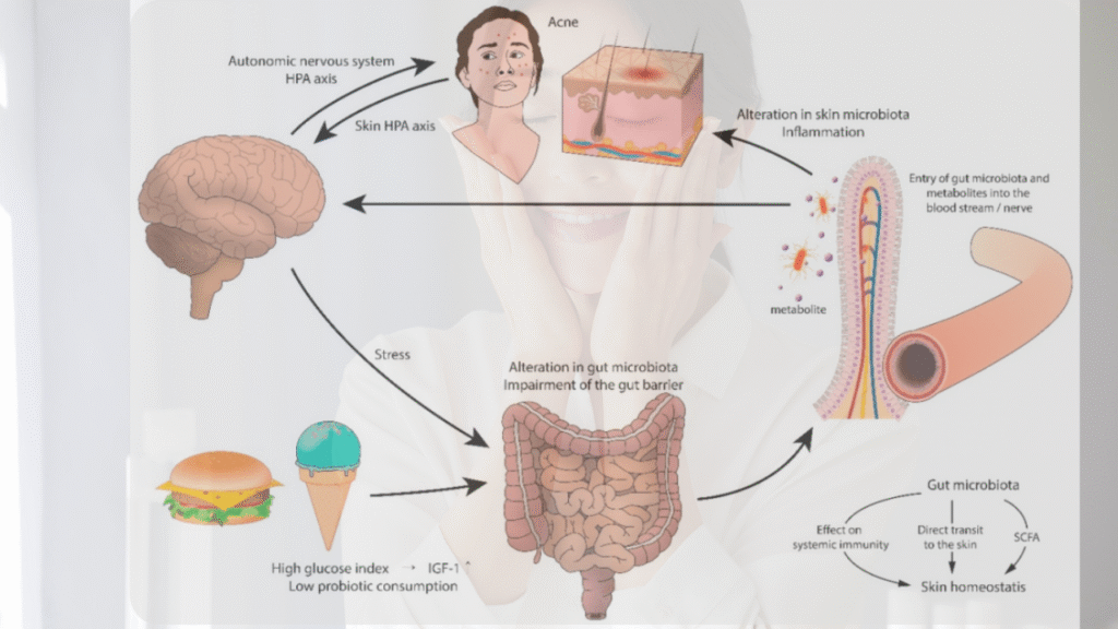 Gut Health impact skin